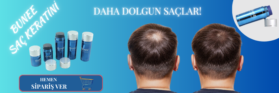 Ana Sayfa Slider